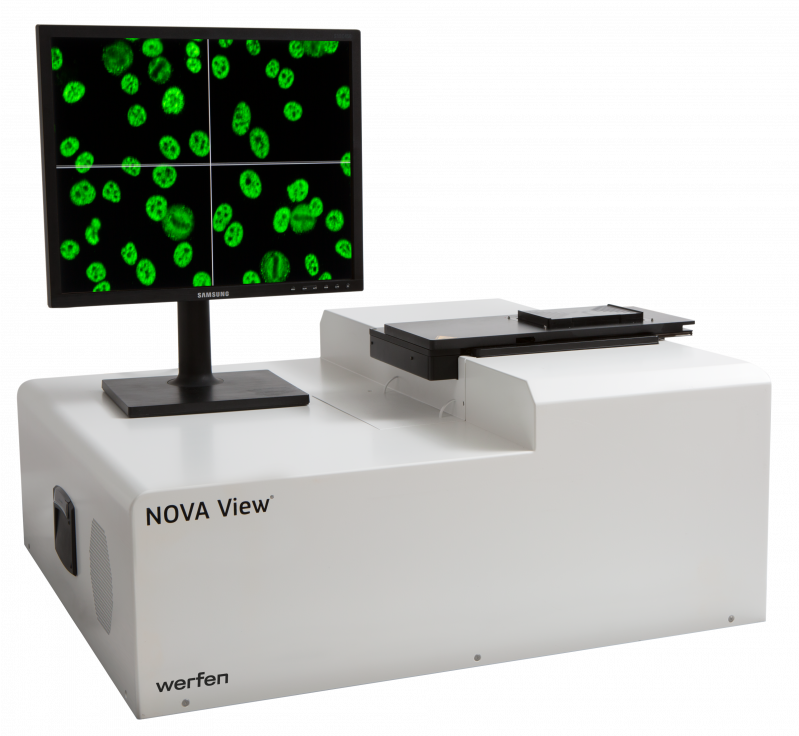 KV